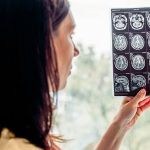 FDA Doesn’t Endorse Leucovorin for Autism, OKs It for Rare Brain Disorder