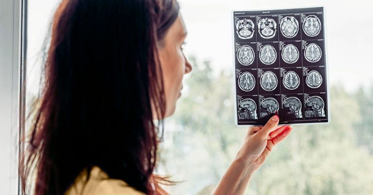 FDA Doesn’t Endorse Leucovorin for Autism, OKs It for Rare Brain Disorder