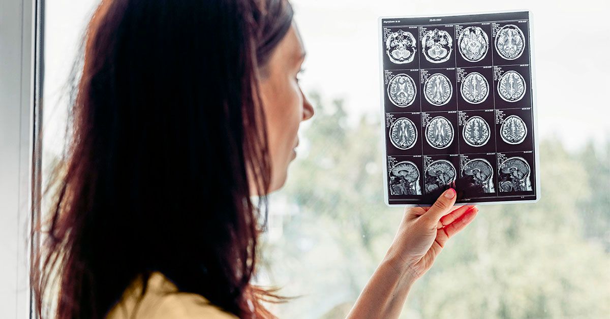 FDA Doesn’t Endorse Leucovorin for Autism, OKs It for Rare Brain Disorder